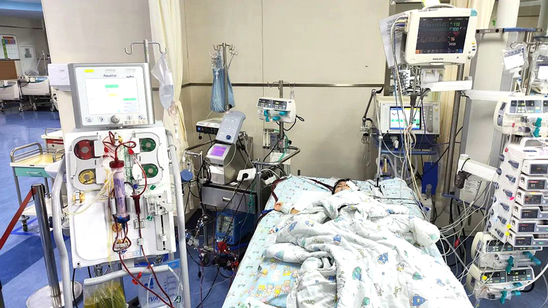 PICU里，上了ECMO+CRRT 的小依依。浙大兒院供圖